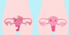 做试管婴儿促排卵会加快卵巢衰老吗？
