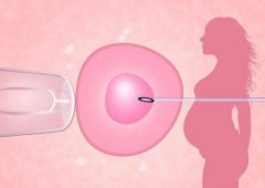 Hello IVF：试管婴儿取卵后，